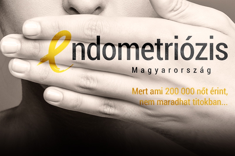 Endometriózis Világnap Nyíregyházán
